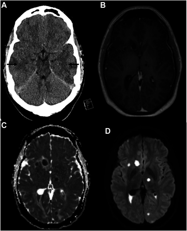 FIGURE 1