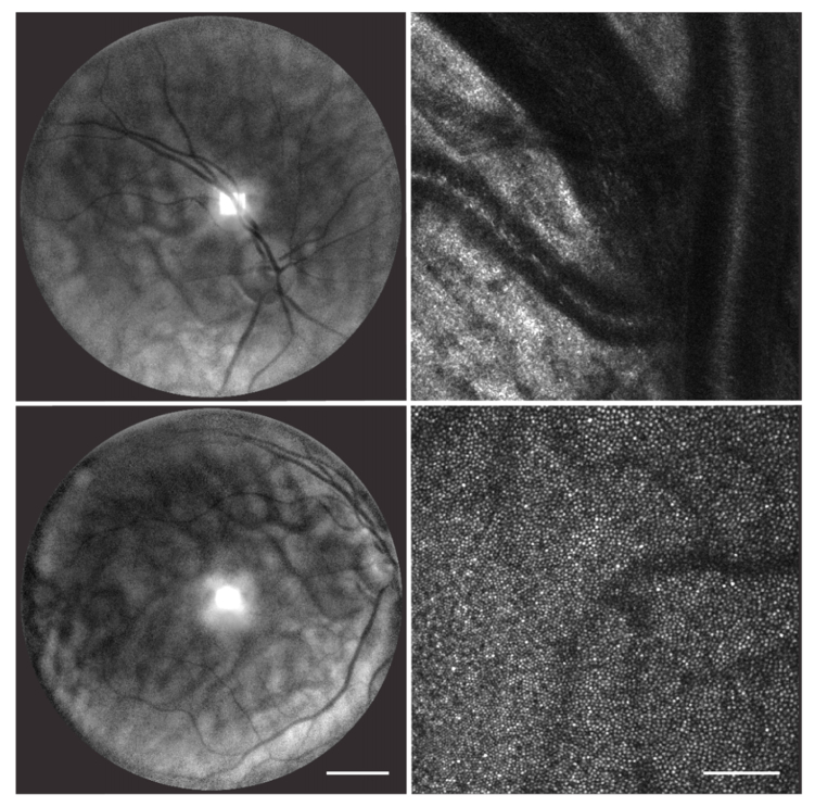 Fig. 14