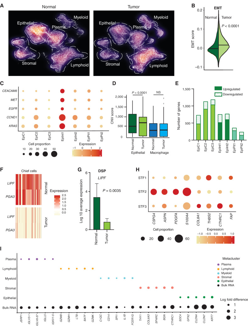 Figure 2. scRNA-seq deconvolutes gastric tumor programs associated with distinct cell states. A, Density plot of UMAP representation comparing normal and gastric tumor samples after random downsampling to approximately 30,000 cells each to allow statistical equivalence. Each dot represents a single cell. Dashed lines highlight higher proportions of epithelial cells in normal samples and myeloid cells in tumor samples. B, Split violin plot of EMT oncogenic gene signature score in normal and tumor cells, showing a significantly higher score in tumor cells. C, Bubble plot depicting the expression of gastric cancer oncogenes in tumor epithelial cell clusters. The size of the circle represents the percentage of cells expressing the gene in that specific epithelial cell cluster, whereas the color represents the average expression of the gene. D, Box plot depicting CNV scores for epithelial cells (green) and macrophage cells (blue) in normal and tumor samples. CNV scores were computed using InferCNV. P values were computed using Wilcoxon rank-sum test. E, Bar graph depicting differences in transcriptomic profiles between tumor and normal tissue by number of upregulated and downregulated genes in epithelial cell clusters. F, Heat map of LIPF and PGA3 gene expression (classic chief cell marker genes) in tumor versus normal samples. Darker color signifies higher expression. G, Gene expression of LIPF by DSP analysis, in tumor epithelial cells (Pan-CK+) compared with normal samples (n = 13). H, Bubble plot depicting sublineage-specific expression of CAF marker genes FAP, CSPG4, PDGFA, ASPN, S100A4, COL8A1, THBS2, and CTHRC1 in fibroblast clusters. STF1 and STF3 are LUM-associated fibroblasts, whereas STF2 comprises proangiogenic pericytes. The size of the circle represents the percentage of cells expressing the gene in that specific fibroblast cell cluster, whereas the color represents the average expression of the gene. I, Bubble plot depicting significant log fold differences in expression of genes between tumor and normal by metacluster mapped against the bulk RNA-seq data (five genes per metacluster are shown). The size of the circle represents the log fold change in the expression of specific genes.