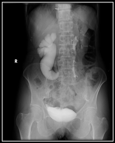 [Table/Fig-1]: