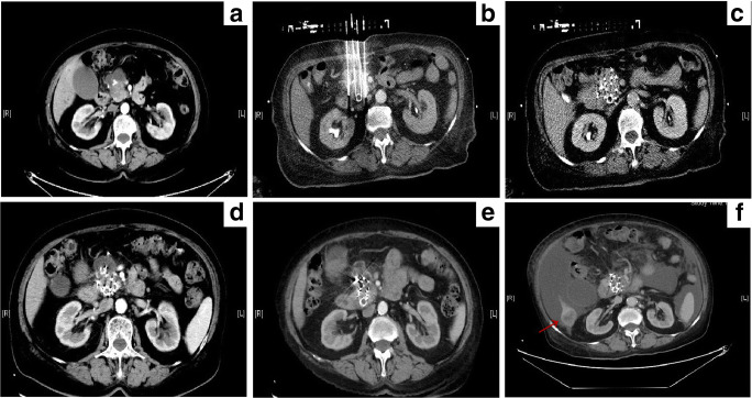 Fig. 6