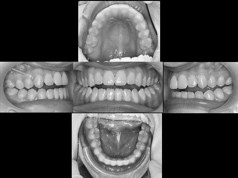 Figure 4. Intraoral photographs.