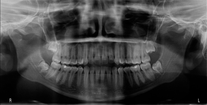 Figure 3. Panoramic radiographs.