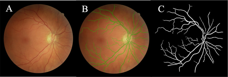 Fig 3