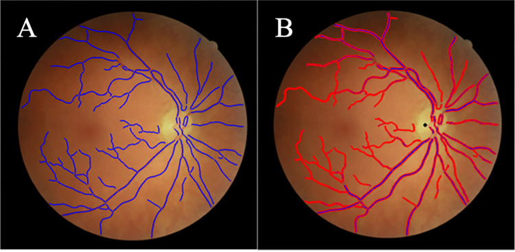 Fig 4