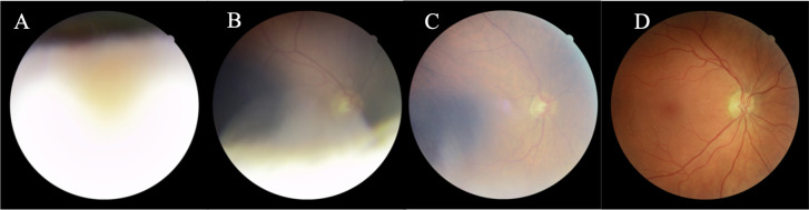 Fig 2