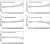Figures 2A to 2E are ribbon plots, plotting difference in villi advanced oxidation protein products (percentage), ranging from negative 20 to 20 in increments of 5 (y-axis) across lag 0 to lag 30 (x-axis) for black carbon concentration all subjects adjusted, organic matter concentration all subjects adjusted, sulfate concentration all subjects adjusted, nitrate concentration all subjects adjusted, ammonium concentration all subjects adjusted.