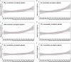 Figures 1A to 1F are ribbon plots, plotting difference in villi advanced oxidation protein products (percentage), ranging from negative 5 to 10 in increments of 5 (y-axis) across lag 0 to lag 30 (x-axis) for particulate matter begin subscript 2.5 end subscript concentration all subjects adjusted, black carbon concentration all subjects adjusted, organic matter concentration all subjects adjusted, sulfate concentration all subjects adjusted, nitrate concentration all subjects adjusted, ammonium concentration all subjects adjusted.