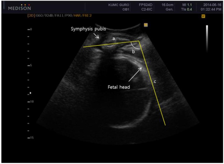 Fig. 2