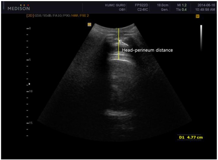 Fig. 1