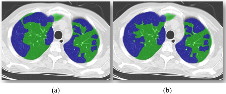 Fig. 12.