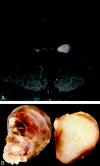 Fig 5.