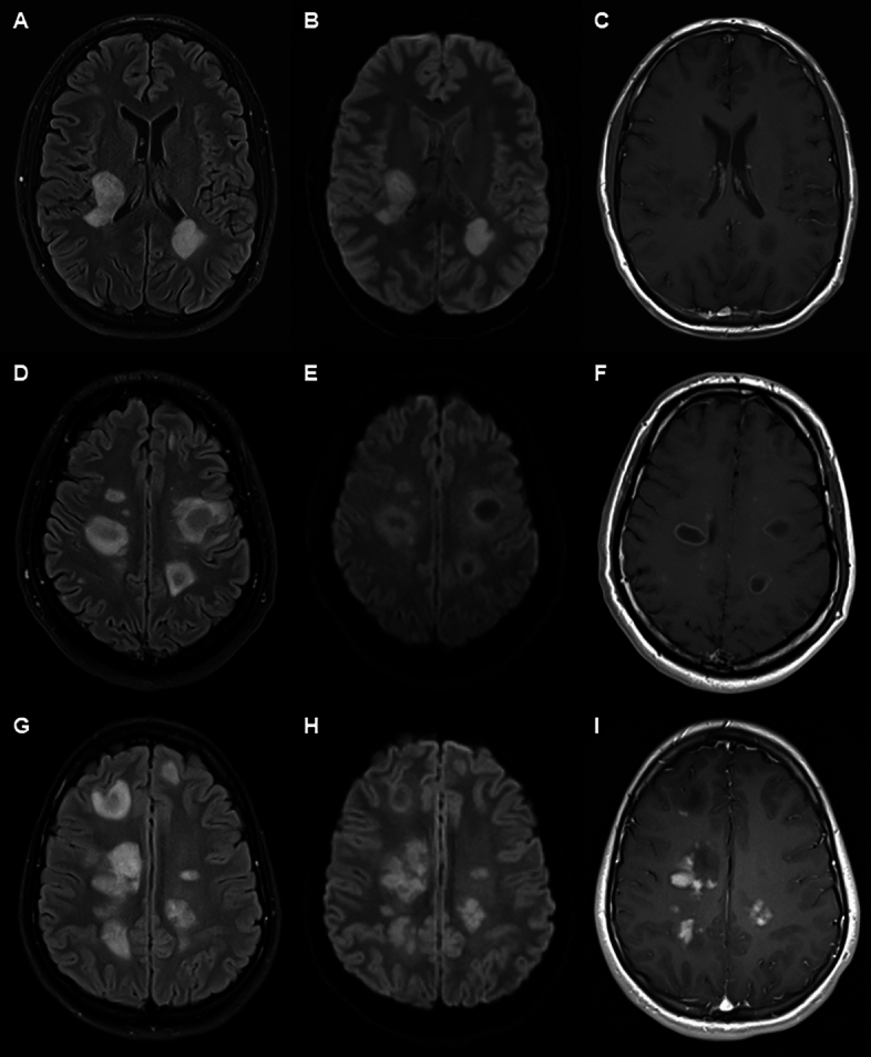 Fig. 2