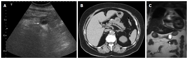 Figure 14