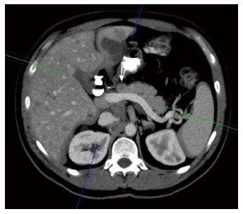 Figure 21