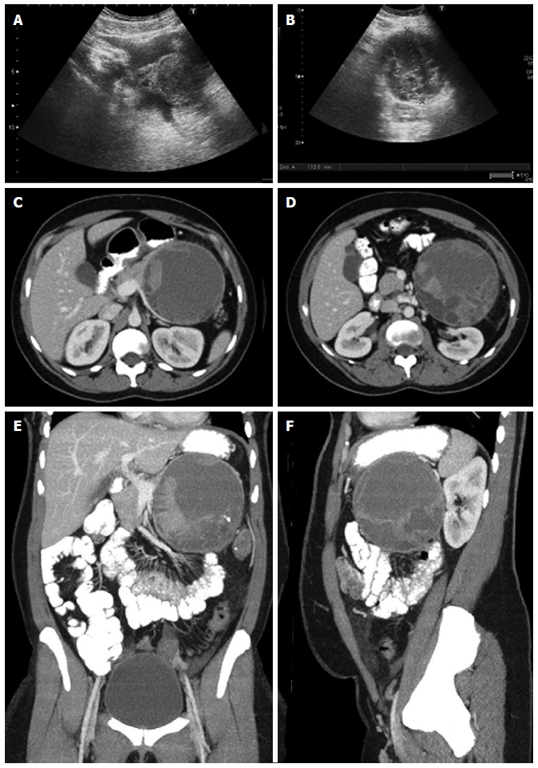 Figure 19