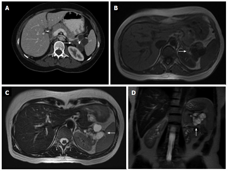 Figure 18