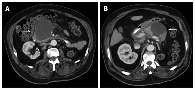 Figure 17