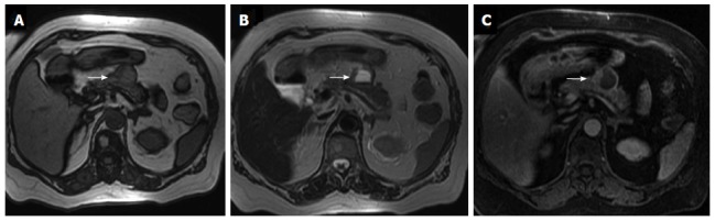 Figure 15