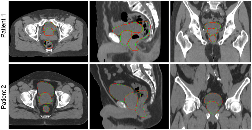 Fig. 5