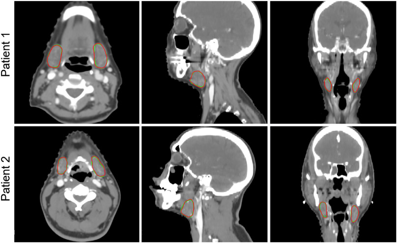 Fig. 9