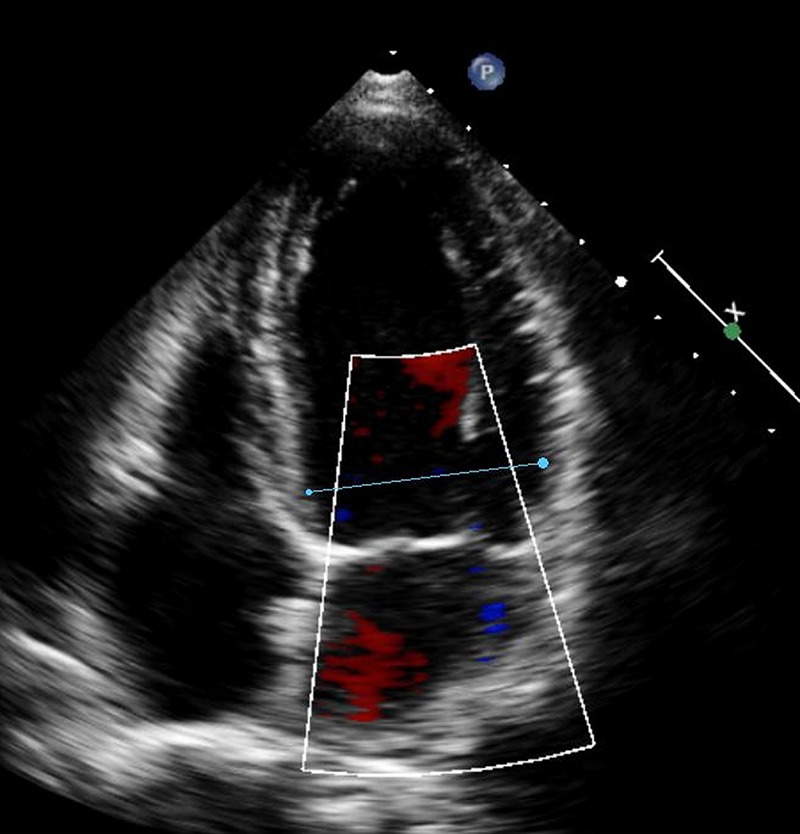 Figure 4