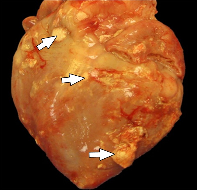 Figure 4b: