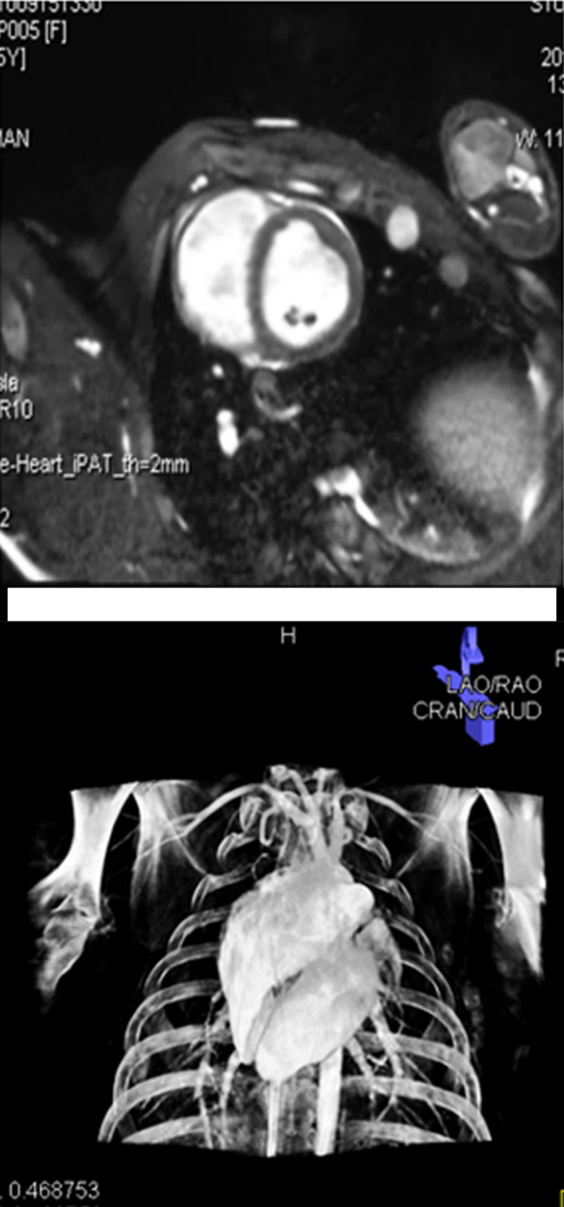 Figure 1a: