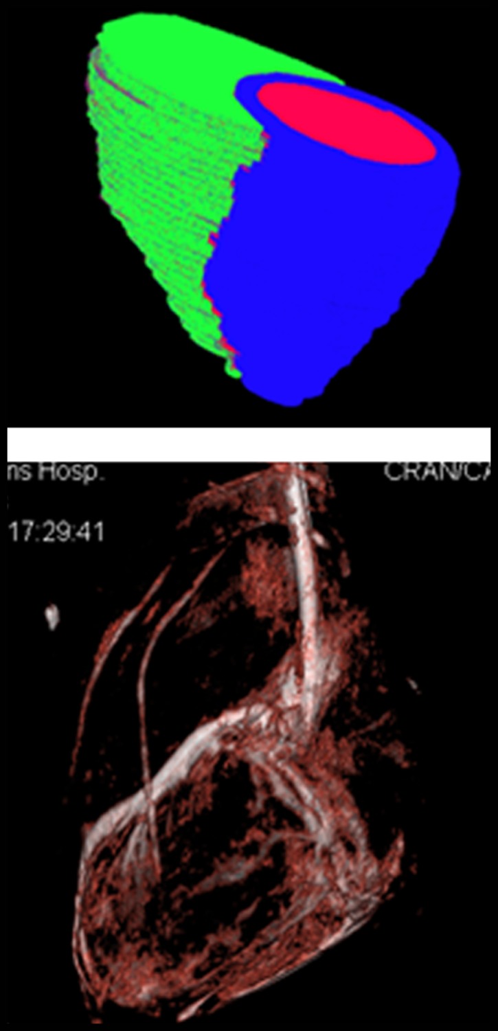 Figure 1c: