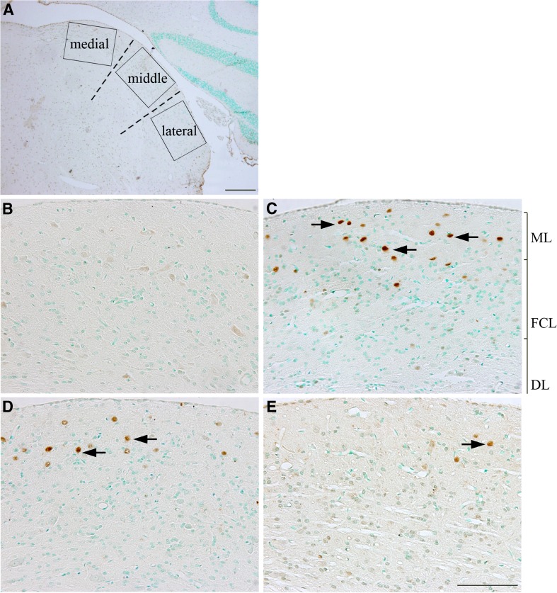 FIG. 11