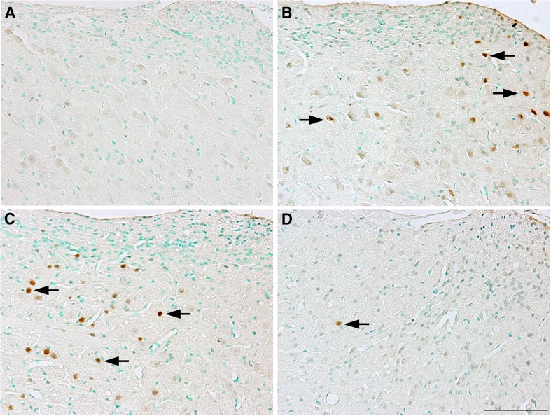 FIG. 13