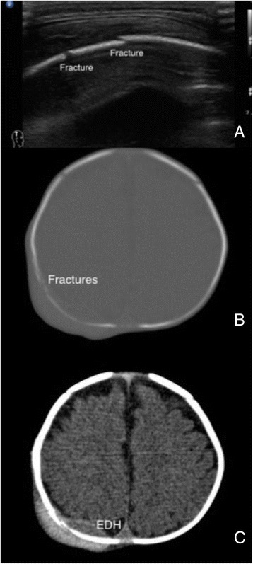 Fig. 6