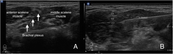 Fig. 12