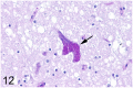 Fig 12