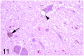 Fig 11