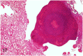 Fig 17