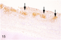 Fig 15
