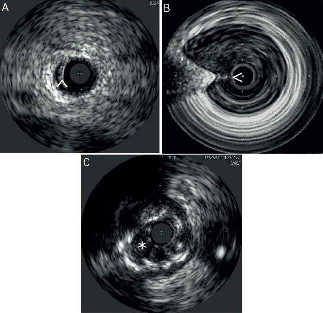 Figure 1: