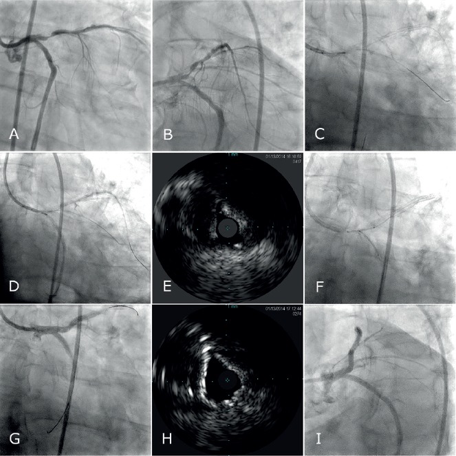 Figure 3: