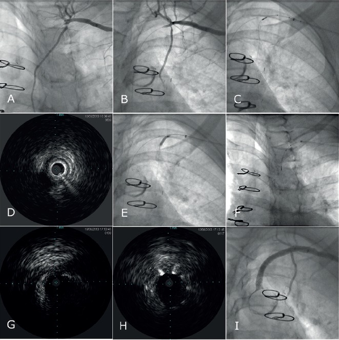 Figure 4: