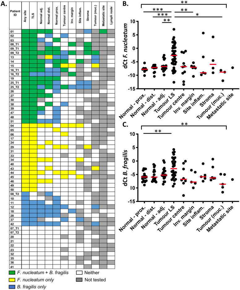 Fusobacterium nucleatum and Bacteroides fragilis detection in ...