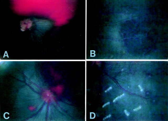 Figure 2  