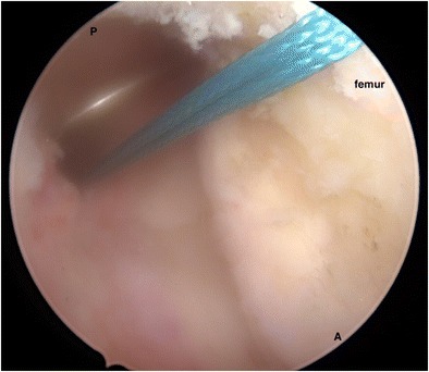 Fig. 8