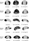 Fig. 11