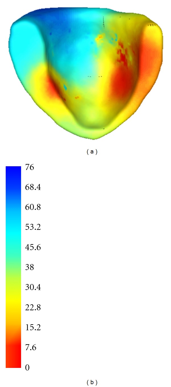 Figure 12