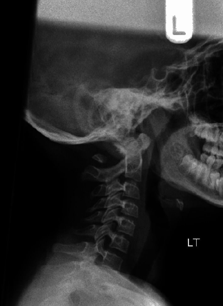 Fig. 1