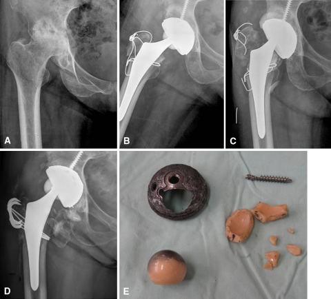 Fig. 1A–E