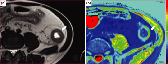 FIGURE 4