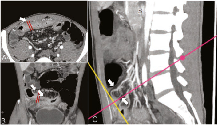 FIGURE 3