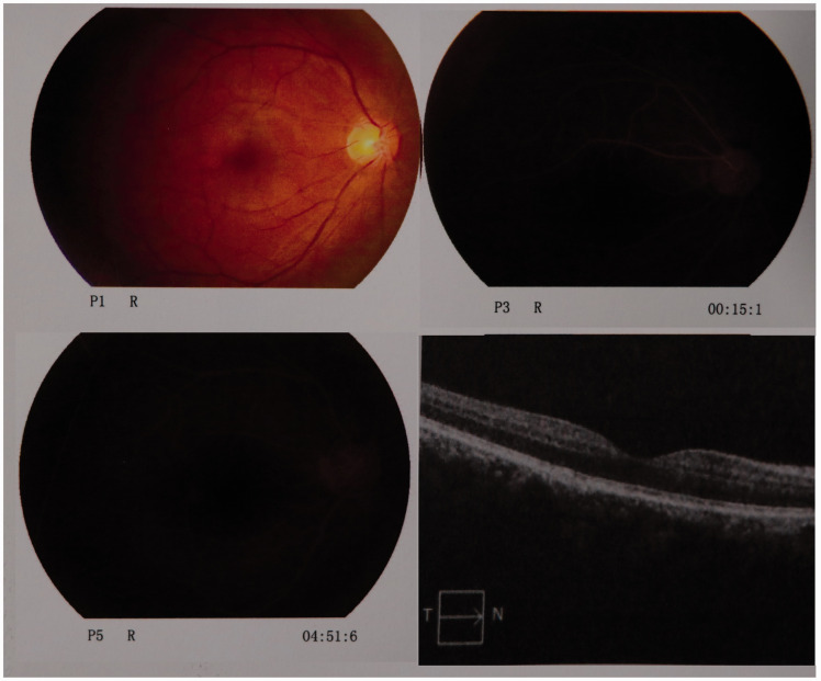 Figure 3.